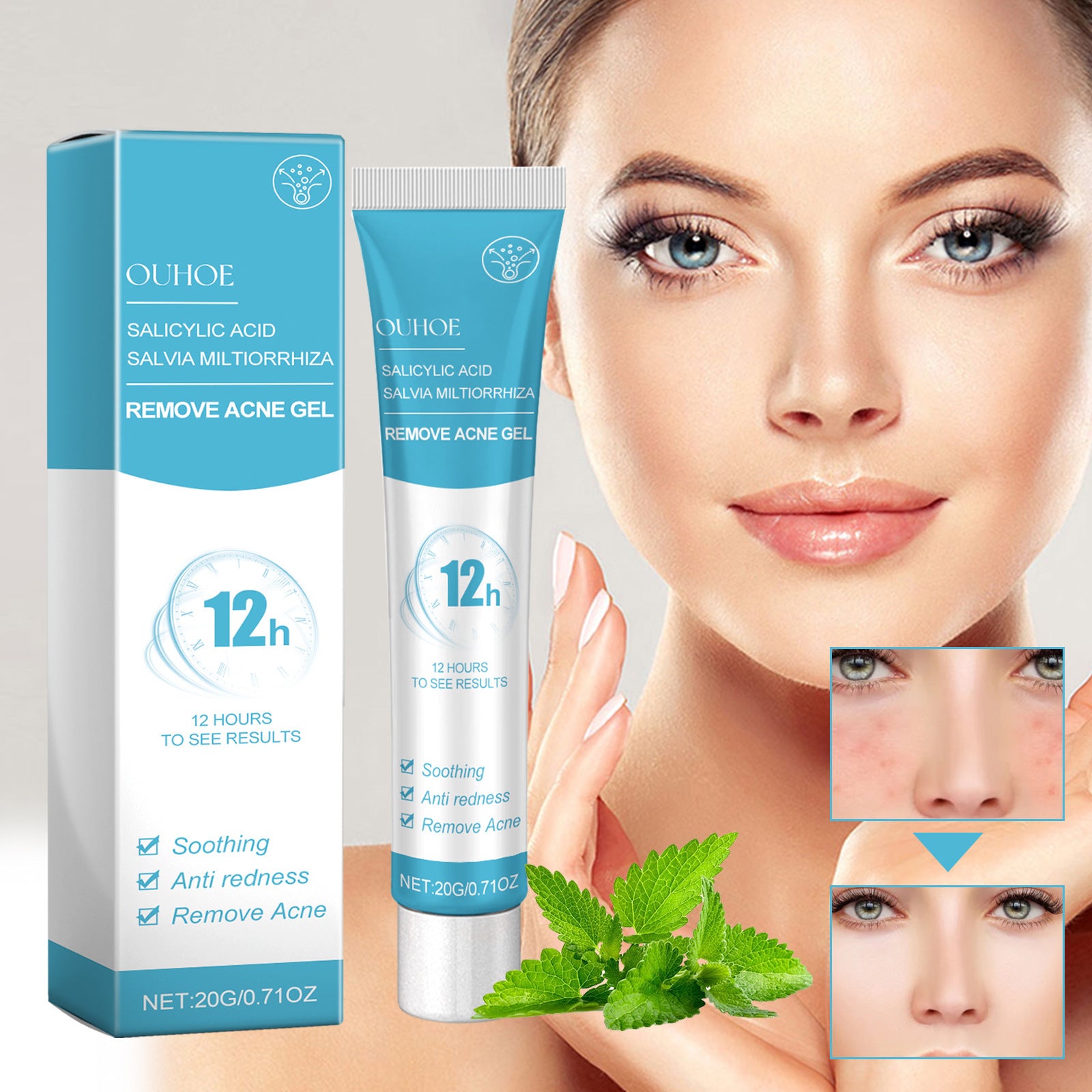 Salicylate Acne Repair Gel