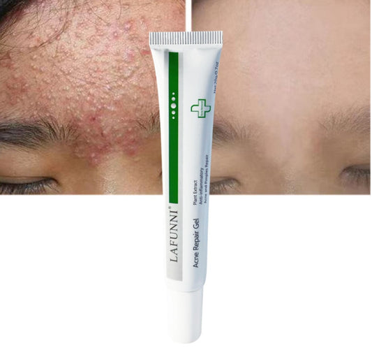 Acne Nourishing Gentle Repairing Acne Spot Gel