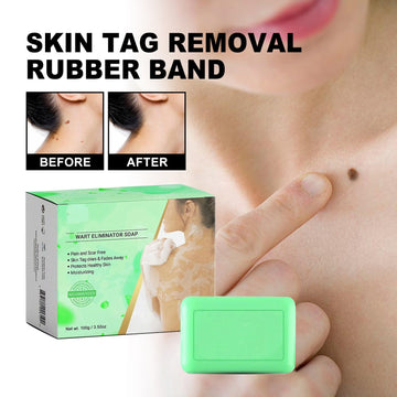 Mole Removal G Wart Grain Filamentous Wart Body Cleaning Soap