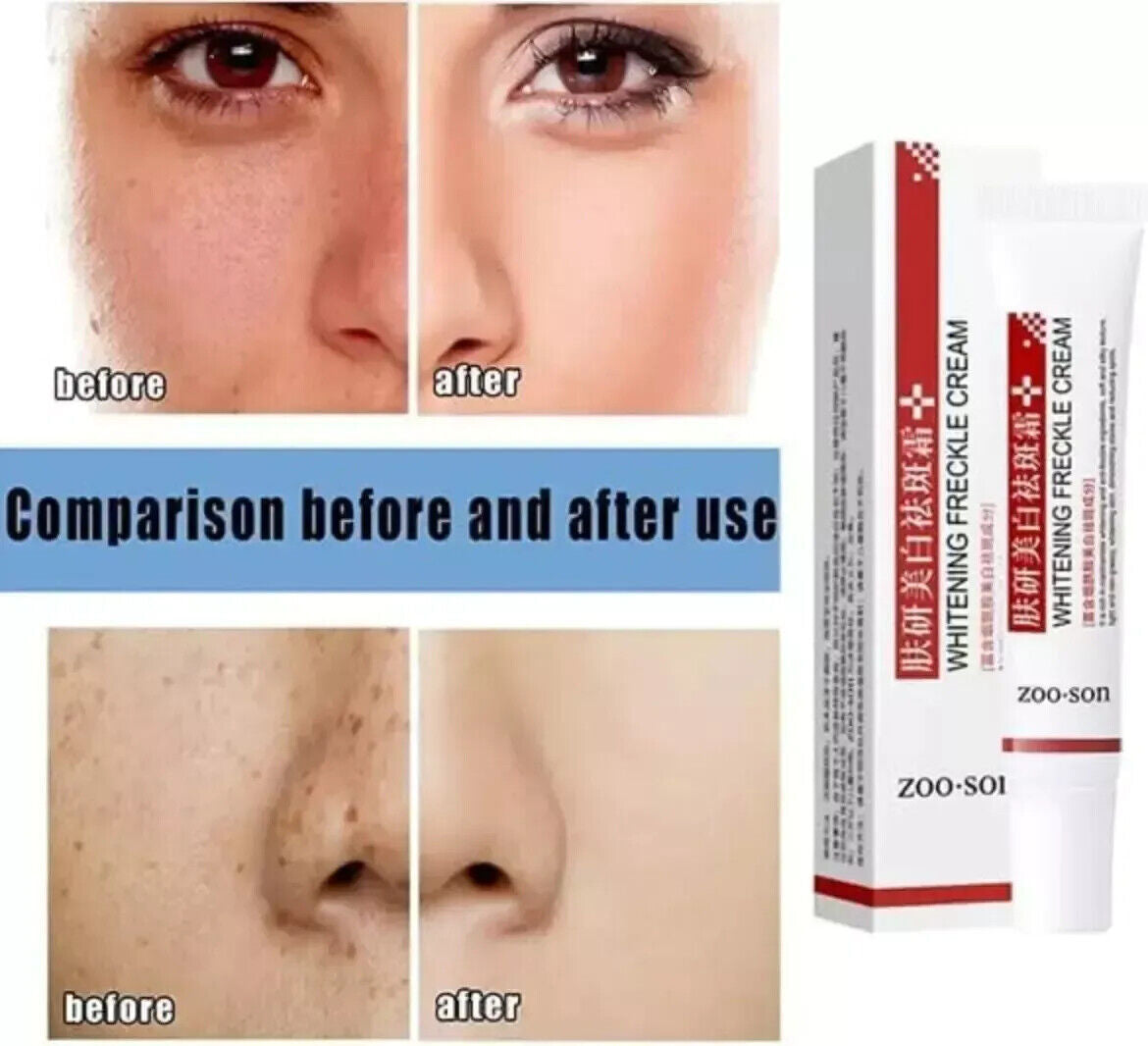 3 Days Dark Skin Permanent Bleaching Cream Whitening Brightening Lightening 2023